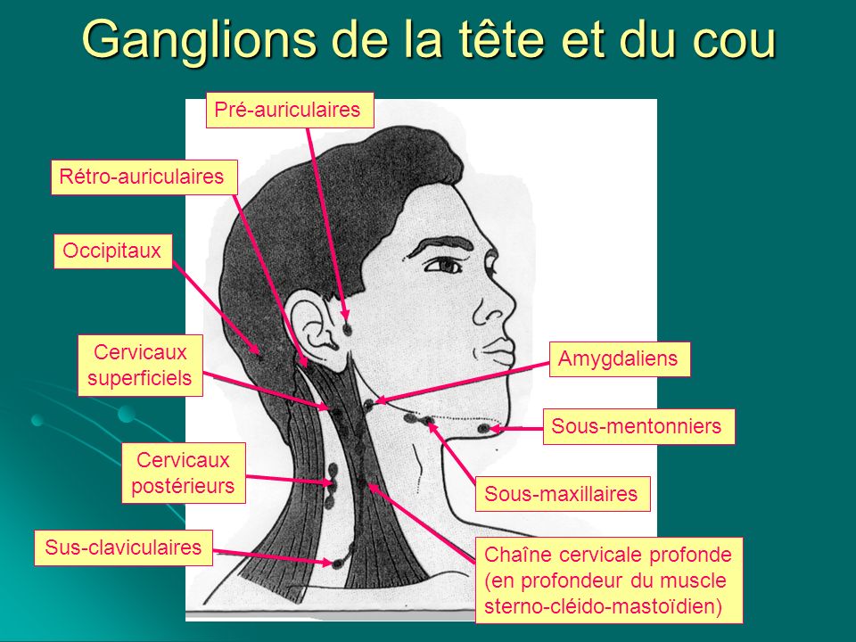 Ganglion Sous Mentonnier Douloureux Victoria Love